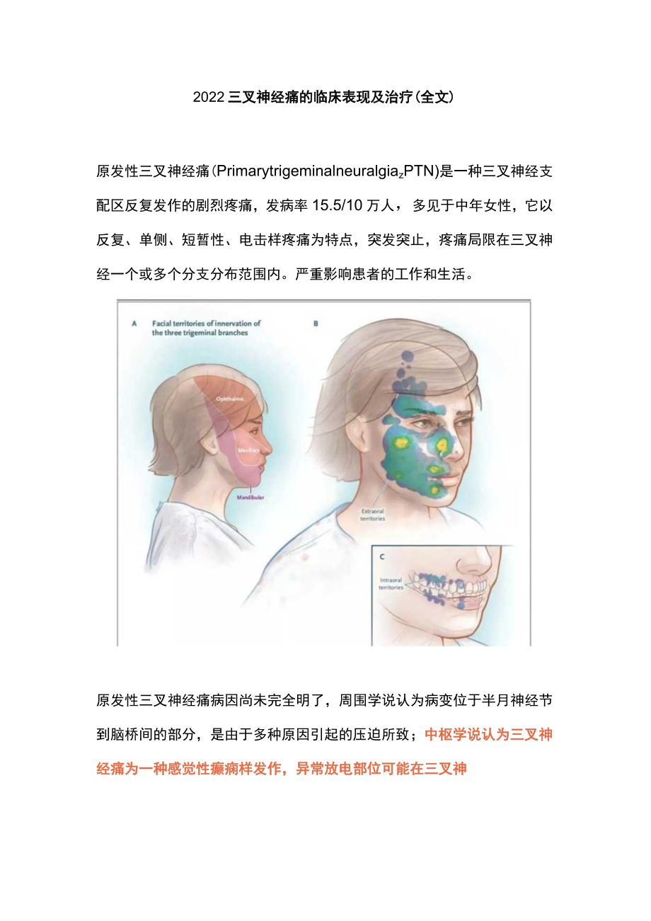 2022三叉神经痛的临床表现及治疗（全文）.docx_第1页