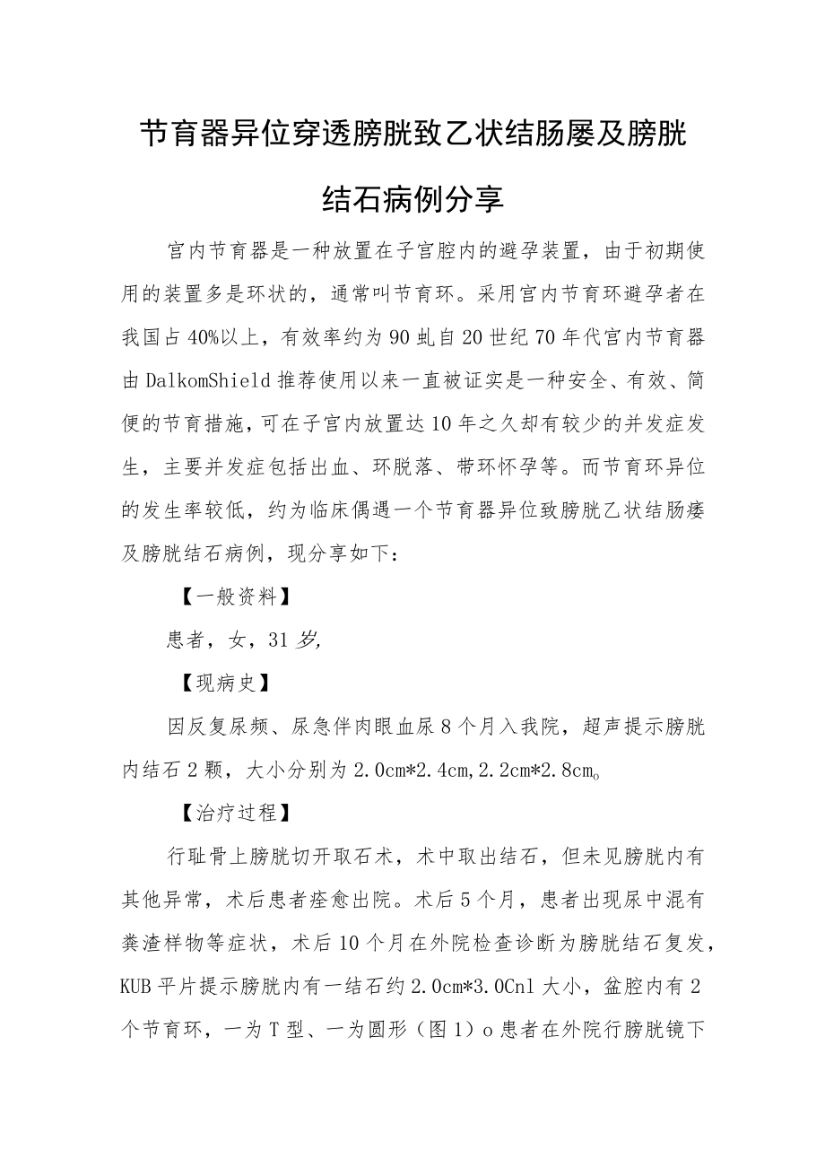 妇产科医师晋升副主任（主任）医师高级职称病例分析专题报告（节育器异位穿透膀胱）.docx_第2页