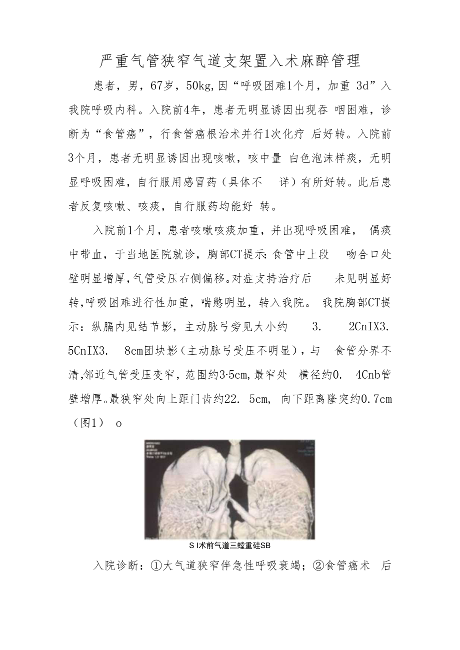 麻醉科医师医师晋升副主任（主任）医师高级职称例分析专题报告（严重气管狭窄气道支架置入术麻醉管理）.docx_第2页