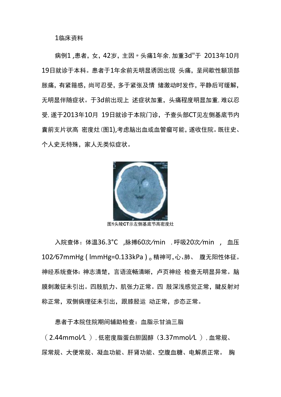 颅内脑发育性静脉异常并发海绵状血管瘤病例分析专题报告.docx_第2页