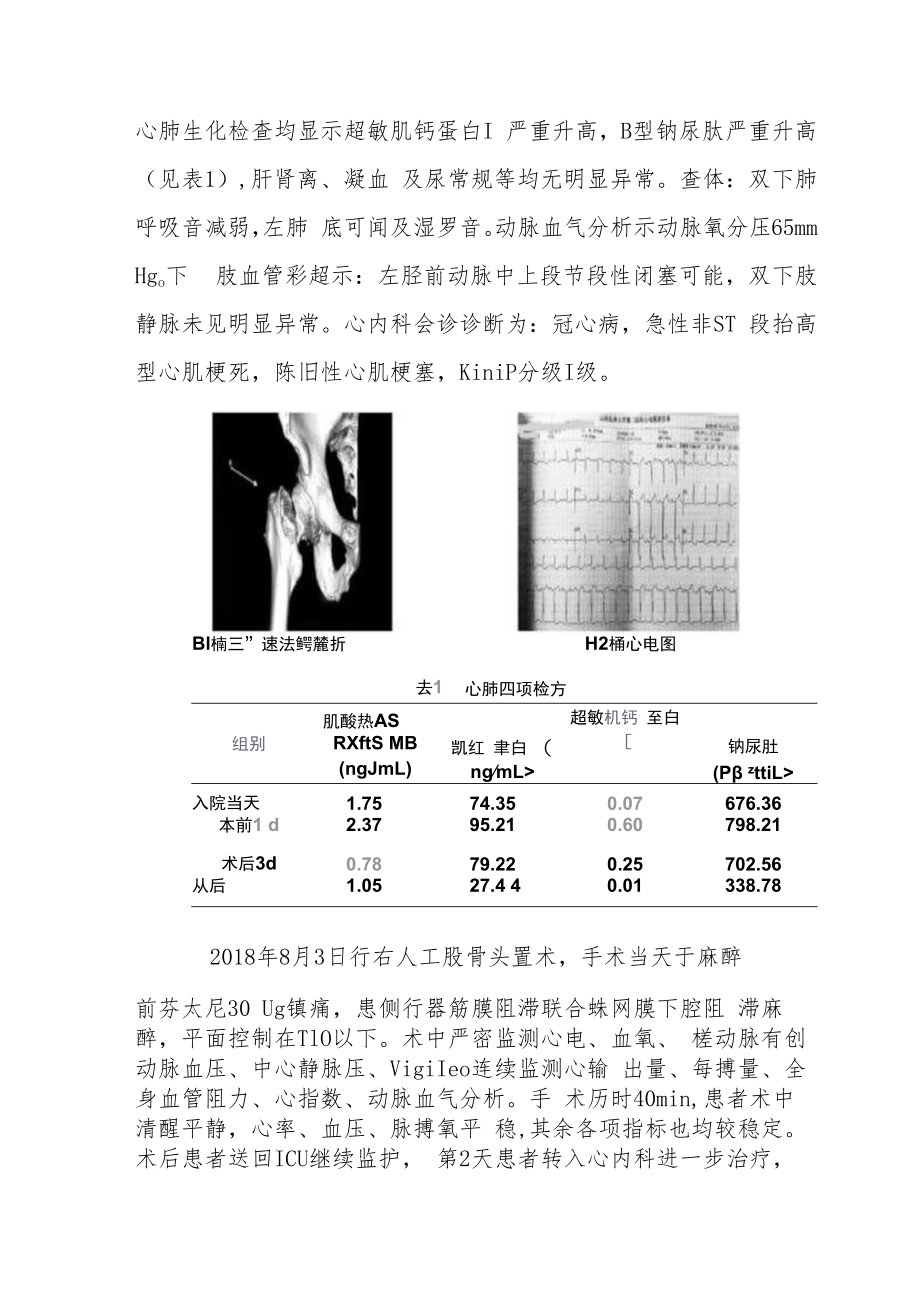 骨科医师医师晋升副主任（主任）医师例分析专题报告（高龄患者髋部骨折再发急性心肌梗死围术期处理）.docx_第3页