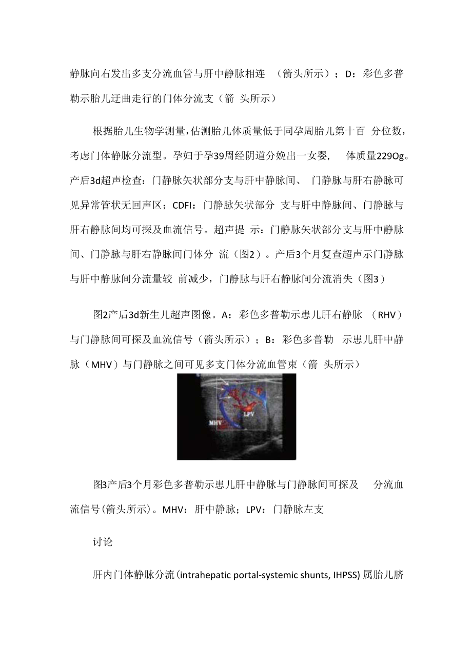 超声科医师晋升副主任（主任）医师高级职称病例分析专题报告（产前超声诊断肝内门体静脉分流）.docx_第3页