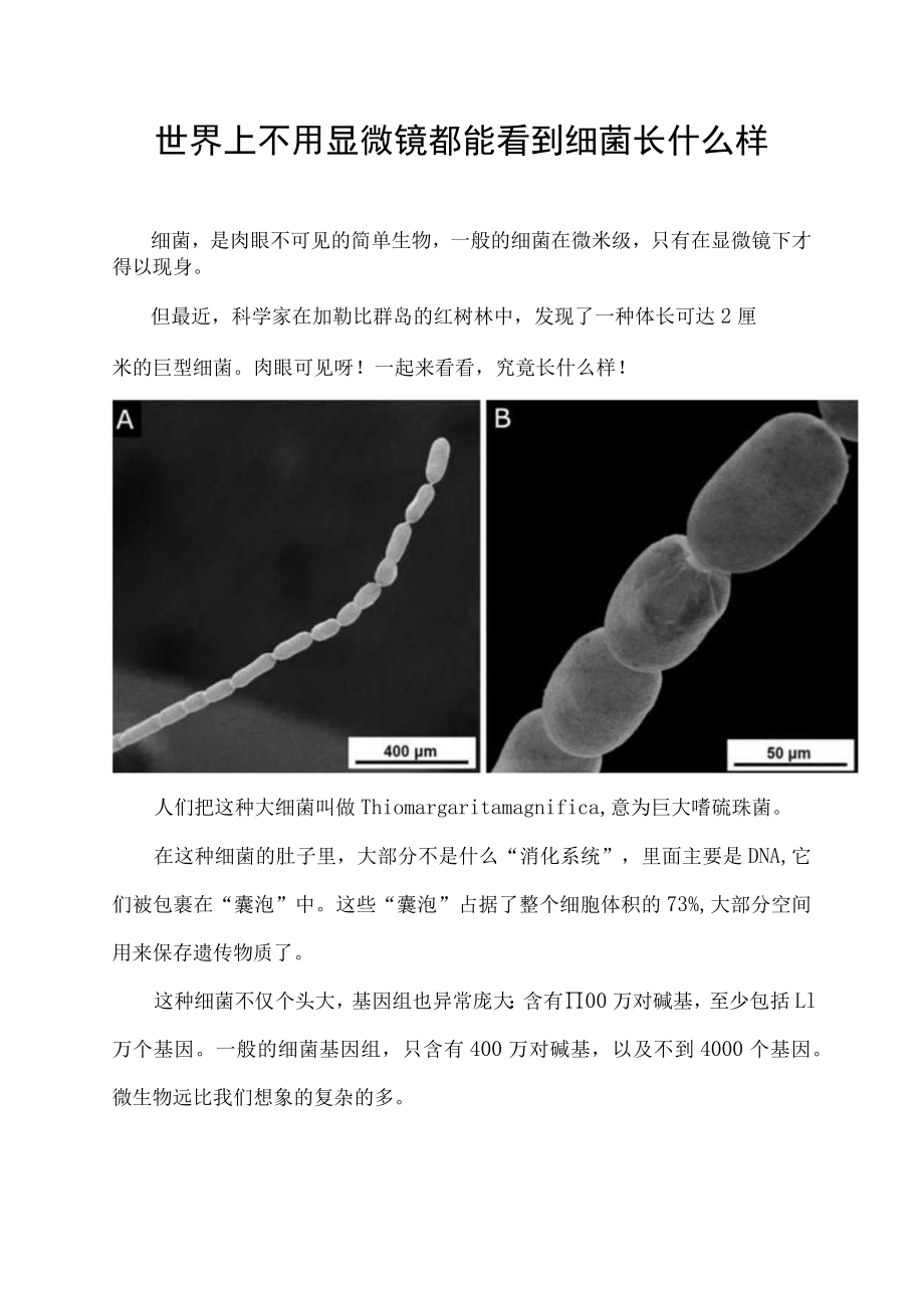 世界上不用显微镜都能看到细菌长什么样.docx_第1页