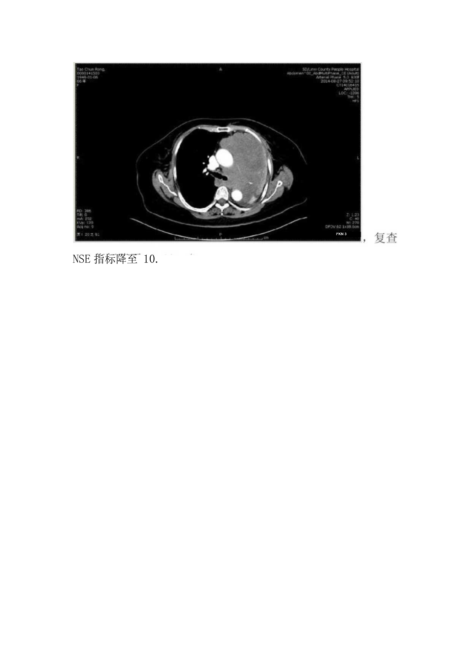 肿瘤标记物在老年肺癌中的应用.docx_第2页