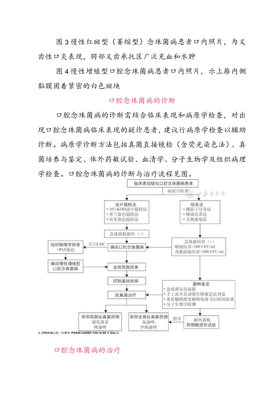 口腔念珠菌病的诊断与治疗.docx_第2页