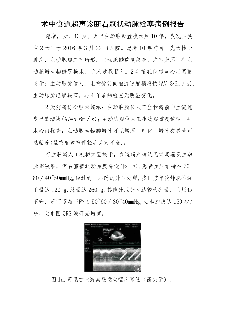 超声科医师（技师）晋升高级职称病例分析专题报告汇编4篇.docx_第2页