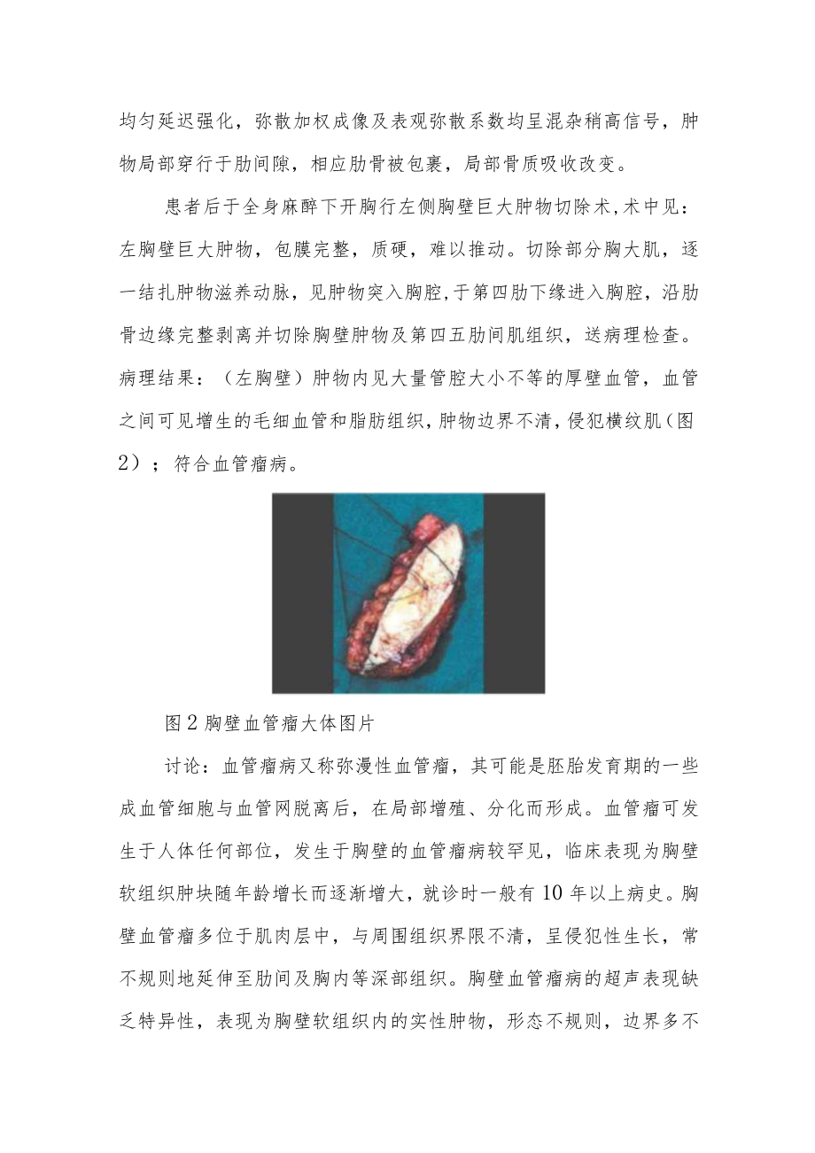 超声科晋升副高（正高）医师职称病例分析专题报告3篇汇编.docx_第3页