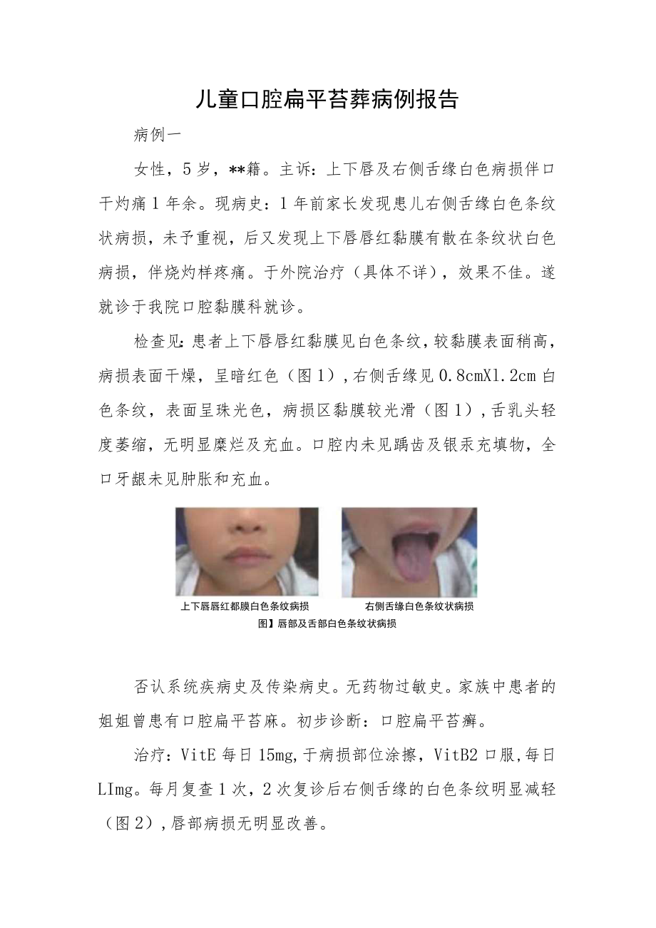 口腔科晋升副高（正高）职称高级职称病例分析专题报告三篇.docx_第2页