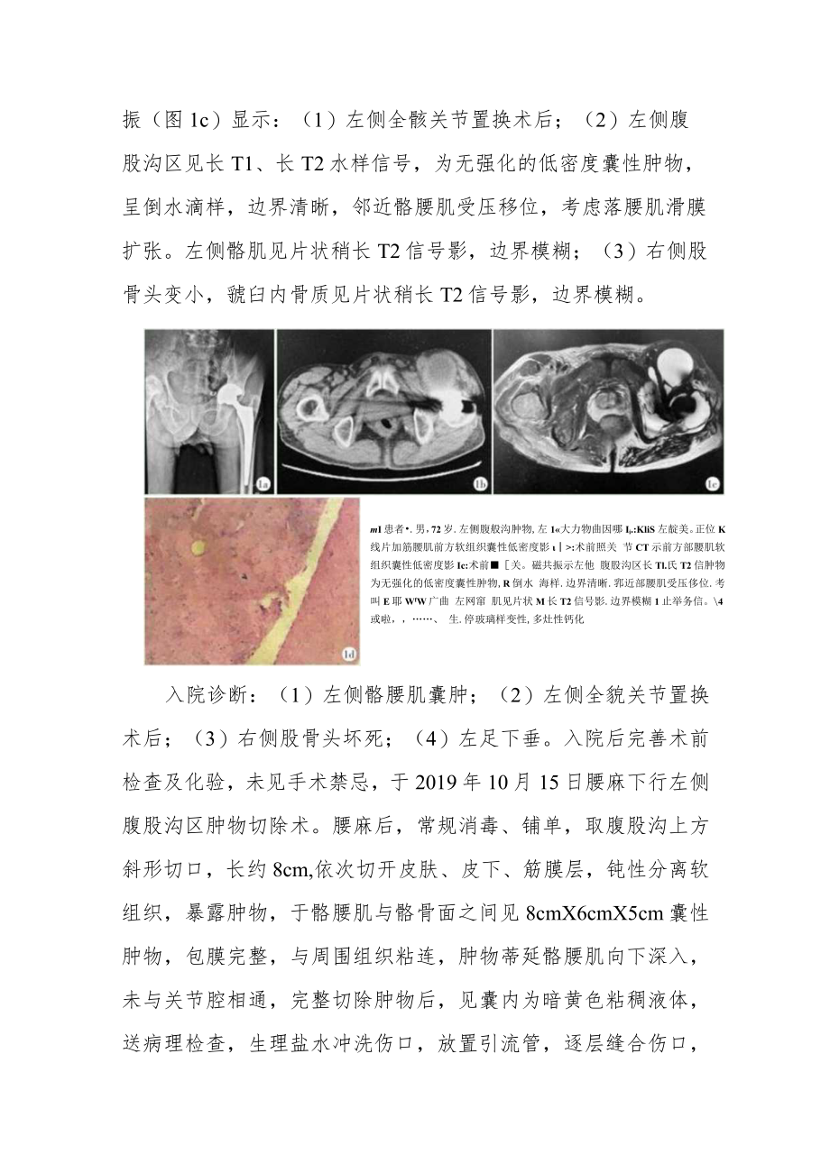 外科晋升副主任医师高级职称病例分析专题报告汇编4篇.docx_第3页