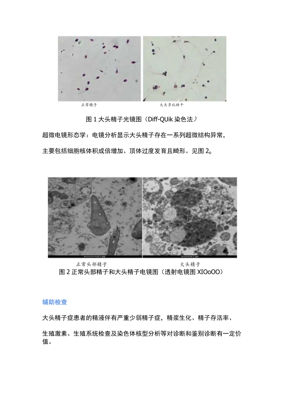 2022大头精子症诊疗专家共识（全文）.docx_第2页