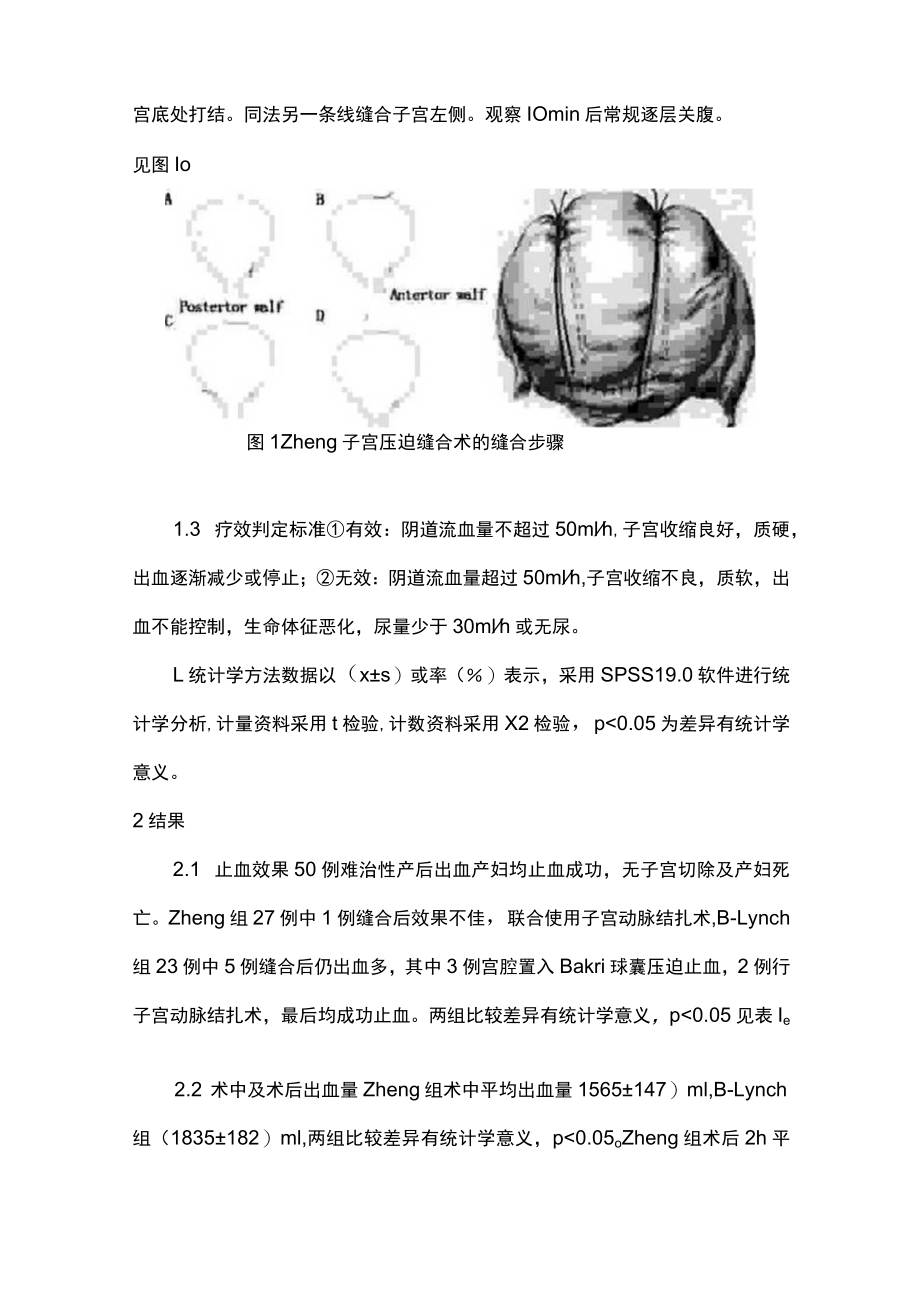 最新：Zheng子宫压迫缝合术救治产后出血的应用（全文）.docx_第3页
