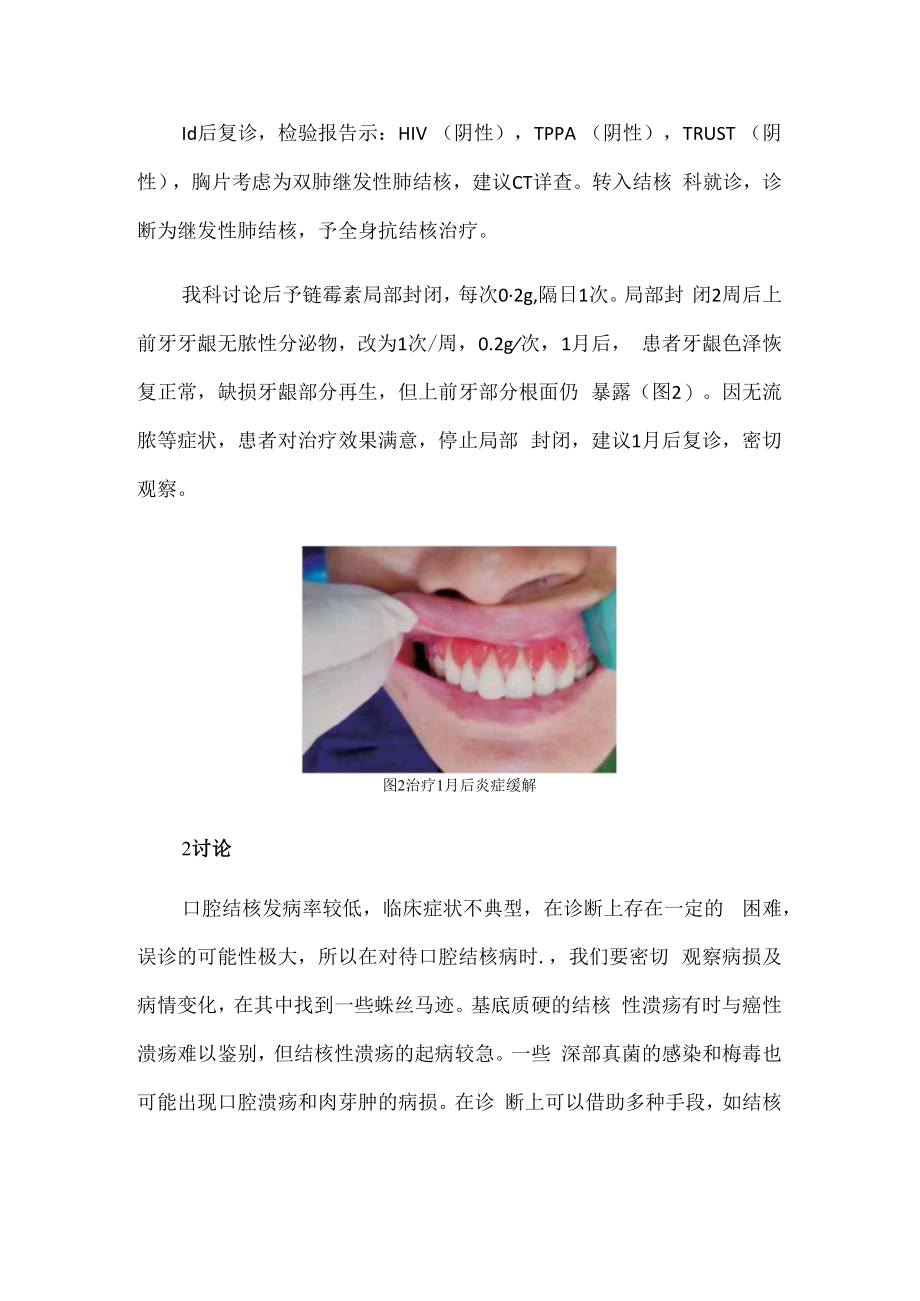 一例口腔牙龈结核病病例分析.docx_第2页