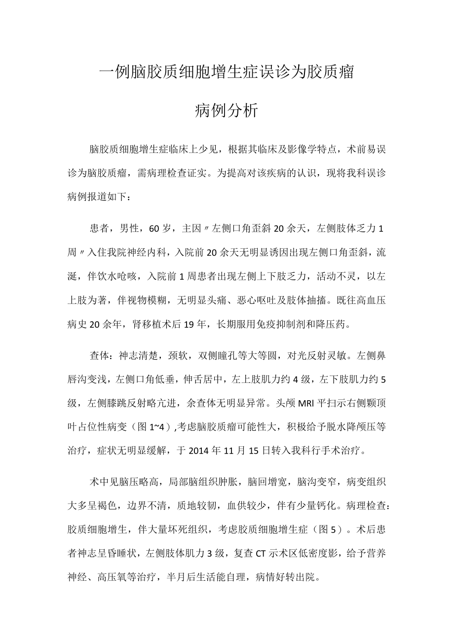 神经内科医师晋升副主任医师高级职称专题报告病例分析（脑胶质细胞增生症误诊为胶质瘤）.docx_第2页