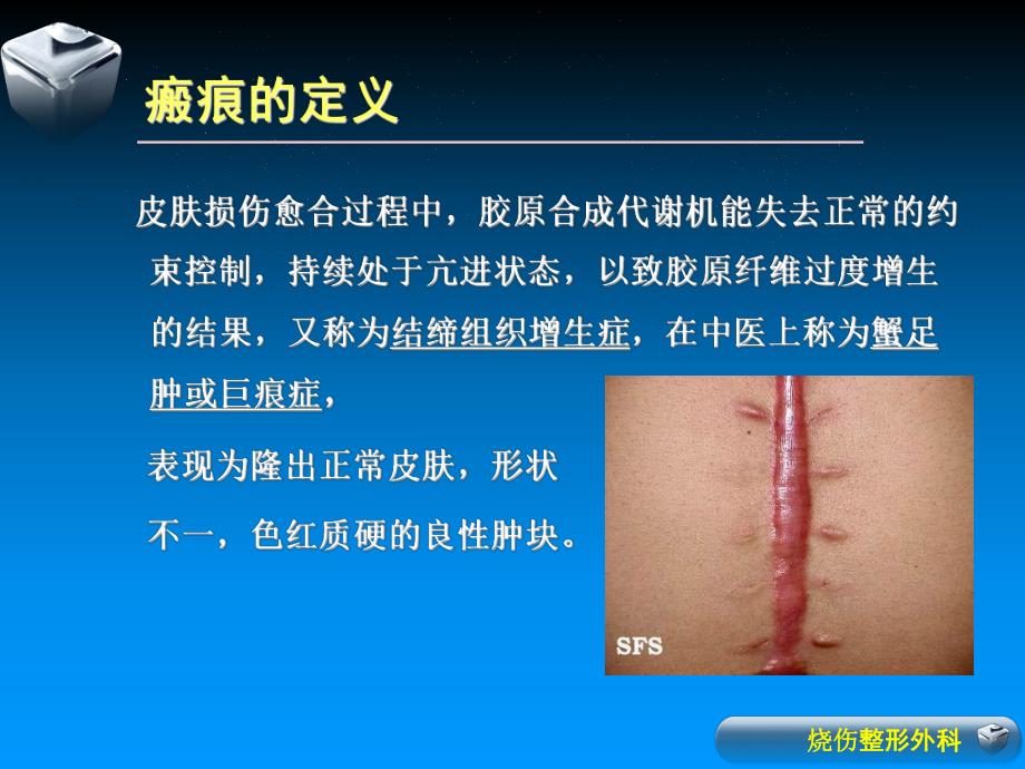 瘢痕的预防和治疗ppt课件.ppt_第2页