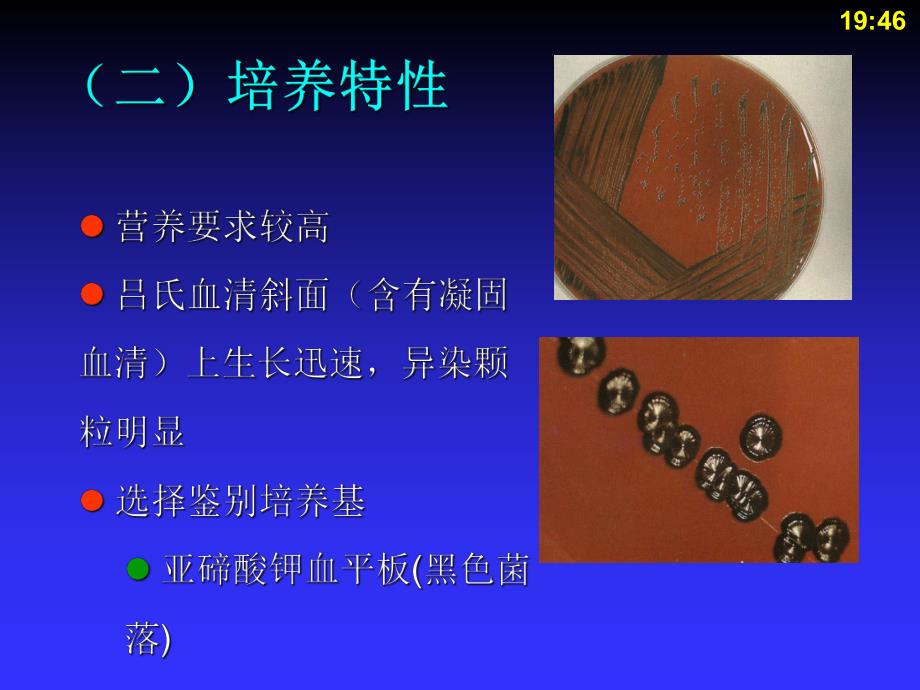 第10章棒状杆菌属.ppt_第3页