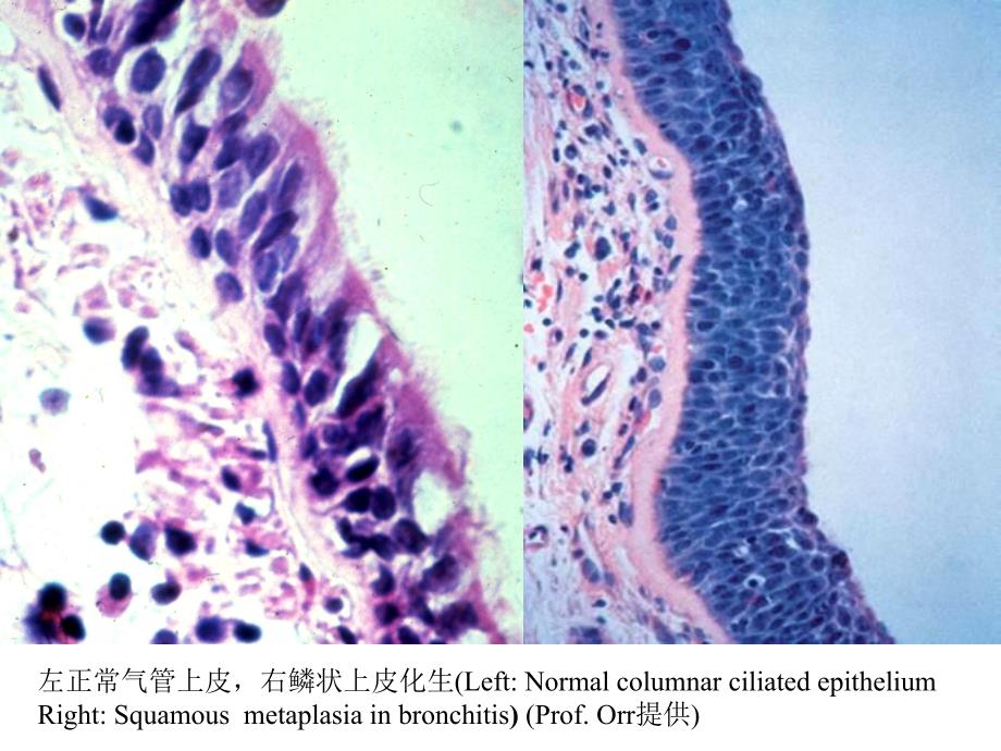 病理学实验教学组织切片示教图选.ppt_第3页