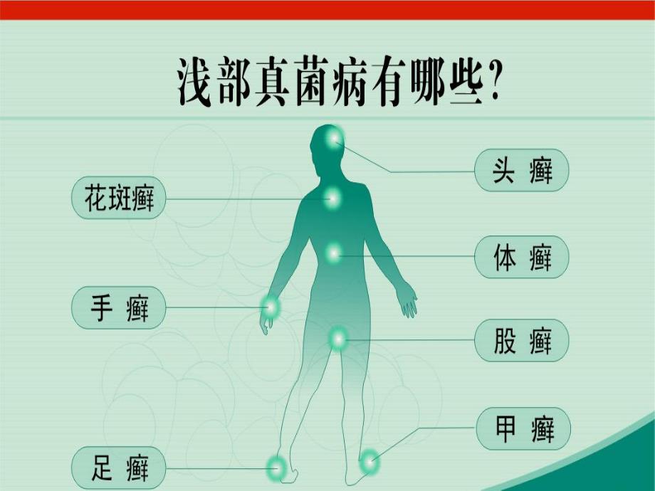 皮肤病概述及治疗ppt课件.ppt_第3页