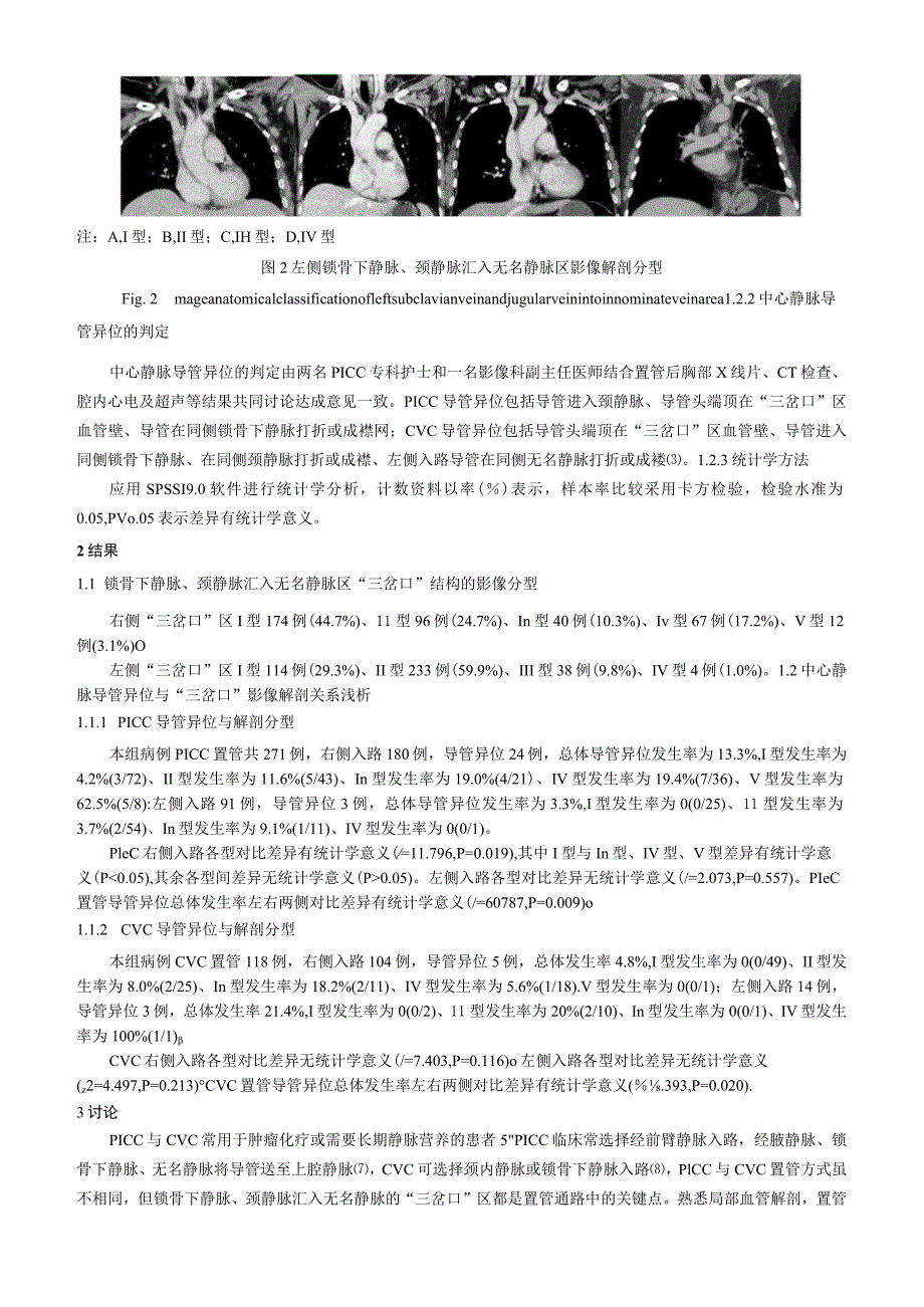 颈静脉、锁骨下静脉汇入无名静脉区的影像解剖分型研究及其在中心静脉置管中的应用浅析.docx_第3页