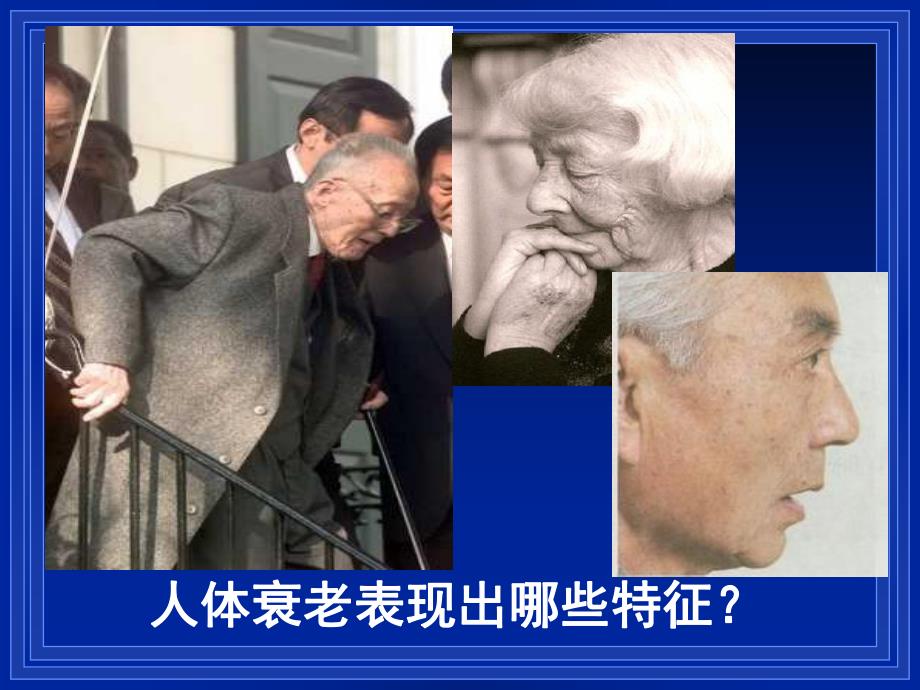 细胞的衰老和凋亡精品教育.ppt_第2页