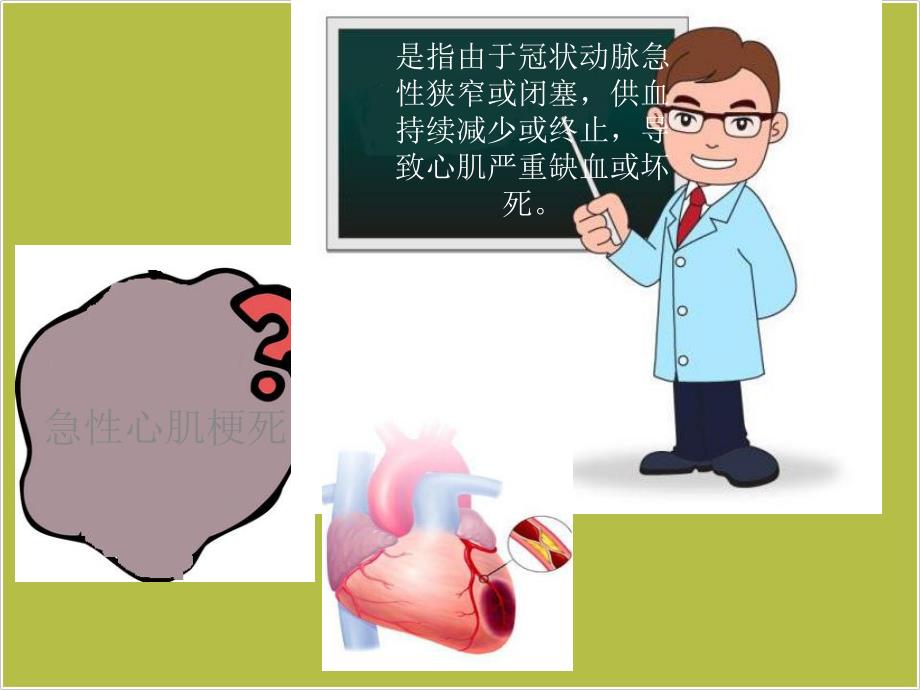 急性心梗教学ppt课件.ppt_第2页