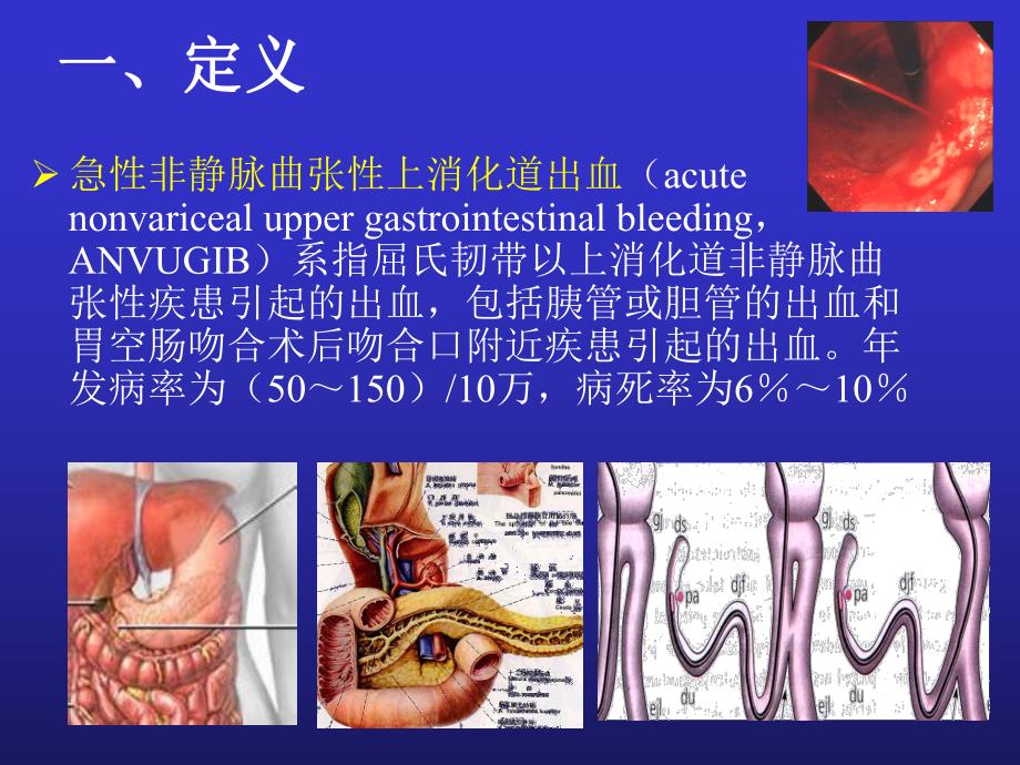 急性非静脉曲张性上消化道出血指南ppt课件.ppt_第2页