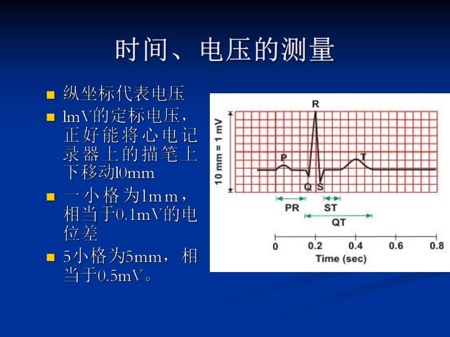 心电图的测量和正常数据.ppt_第3页