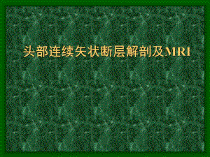 头部连续矢状断层解剖及MRI名师编辑PPT课件.ppt
