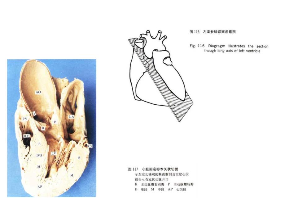 心脏超声科室讲座.ppt_第2页