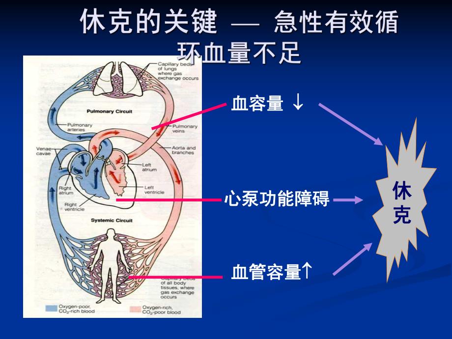 感染性休克的液体治疗.ppt_第3页