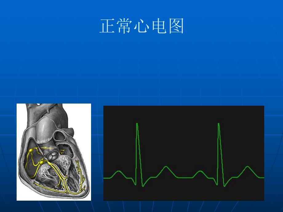 恶性心律失常的识别名师编辑PPT课件.ppt_第2页