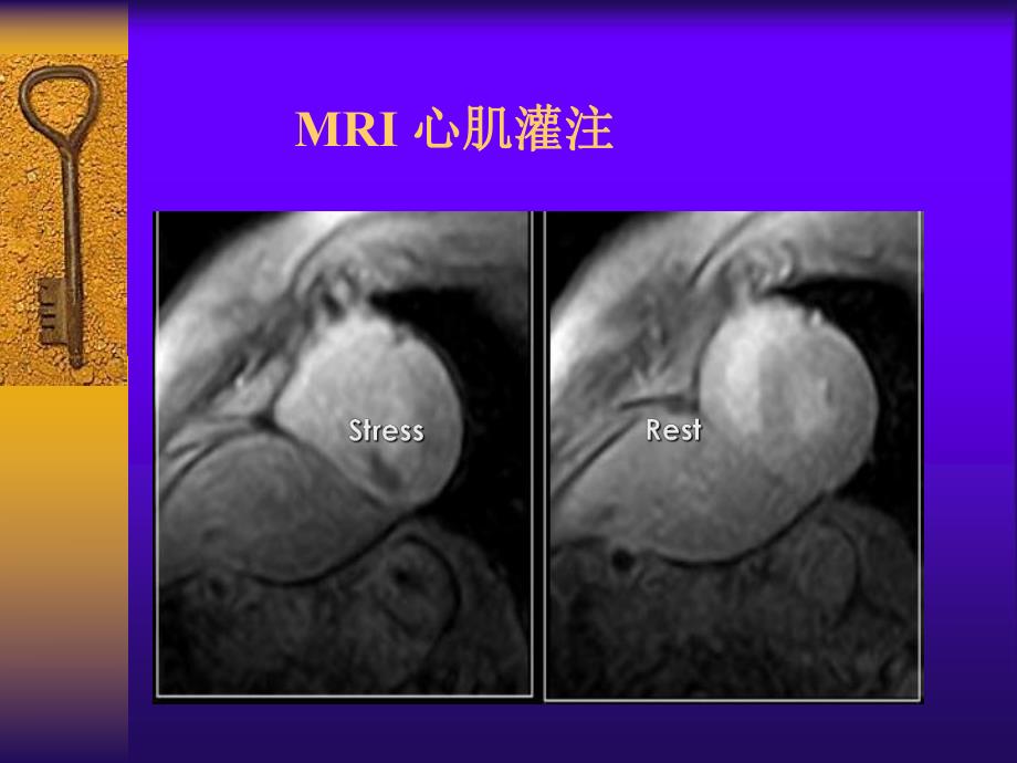 心脏与大血管.ppt_第3页