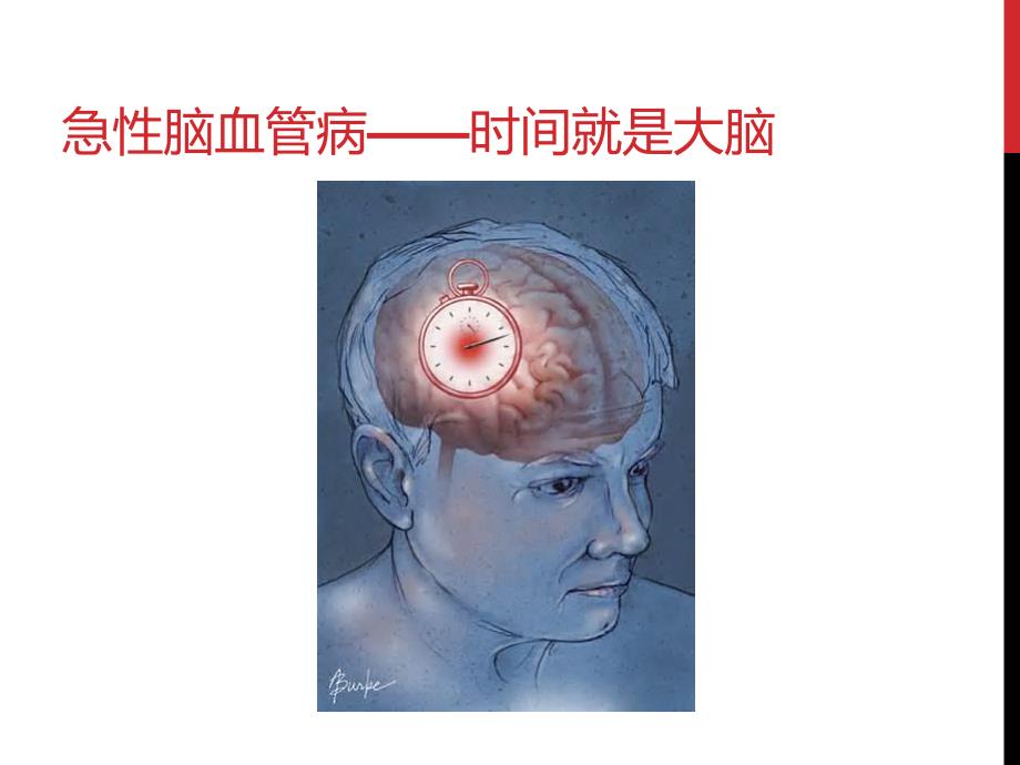 急性脑卒中医疗救治技术方案.ppt_第2页