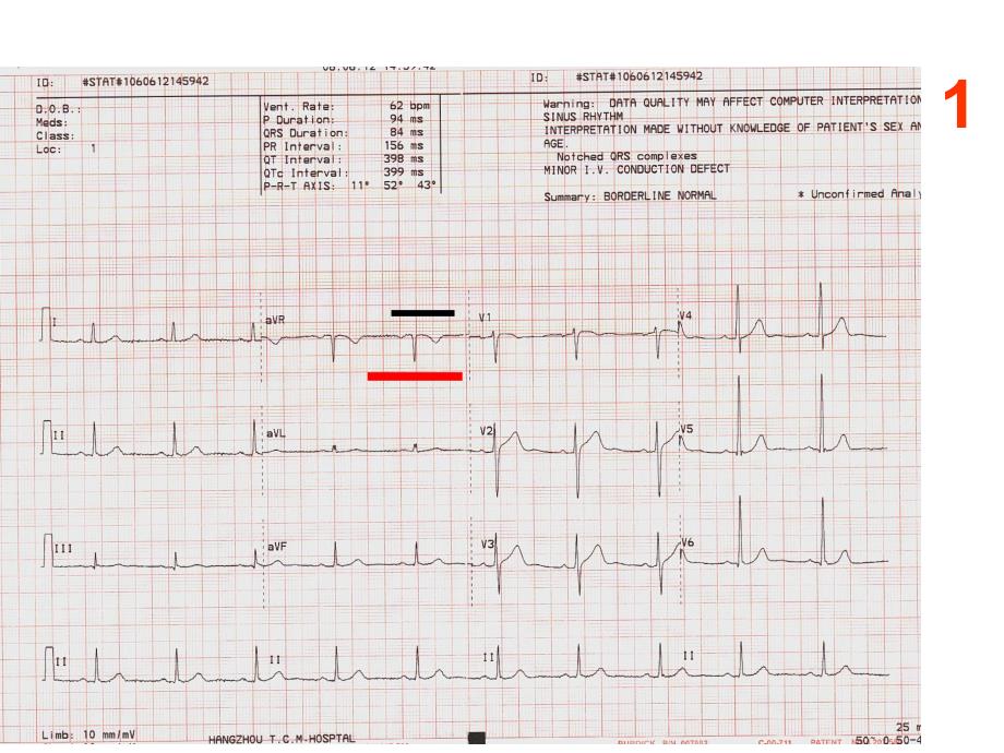 心电图考核图谱.ppt_第2页