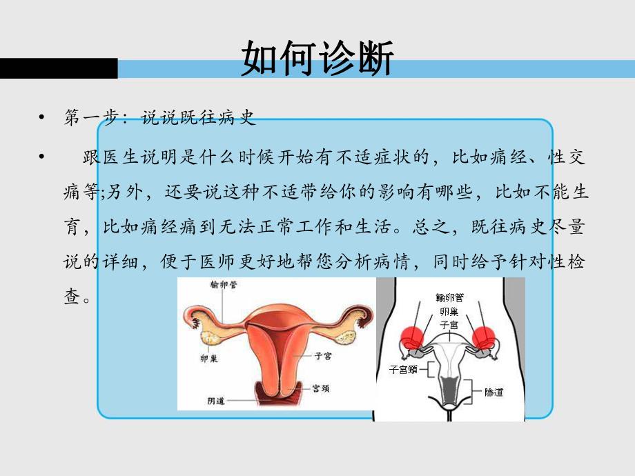 子宫内膜异位症诊断名师编辑PPT课件.ppt_第3页