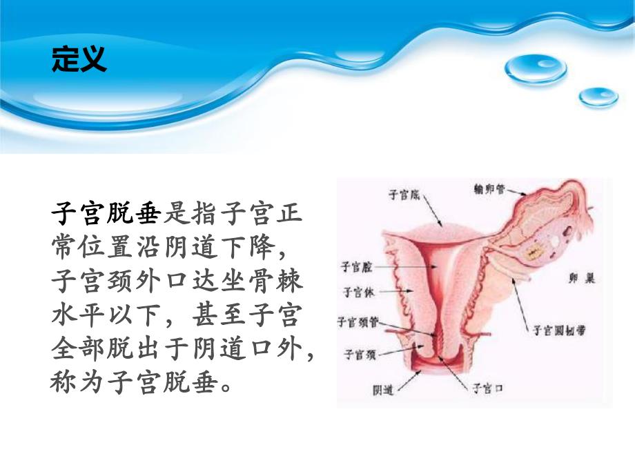 子宫脱垂名师编辑PPT课件.ppt_第3页