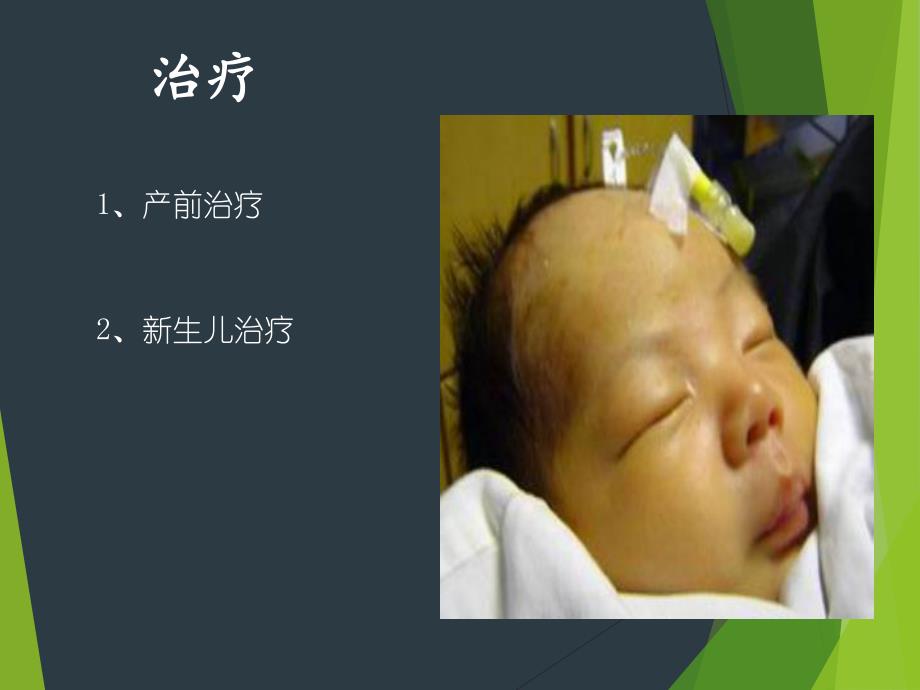 新生儿溶血治疗.ppt_第2页