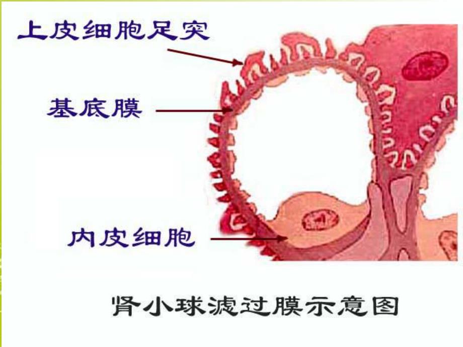 抗肾小球基底膜抗体病.ppt_第2页