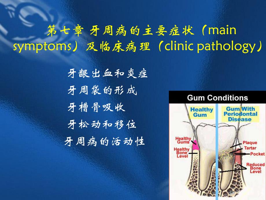 第七章牙周病的主要症状.ppt_第1页