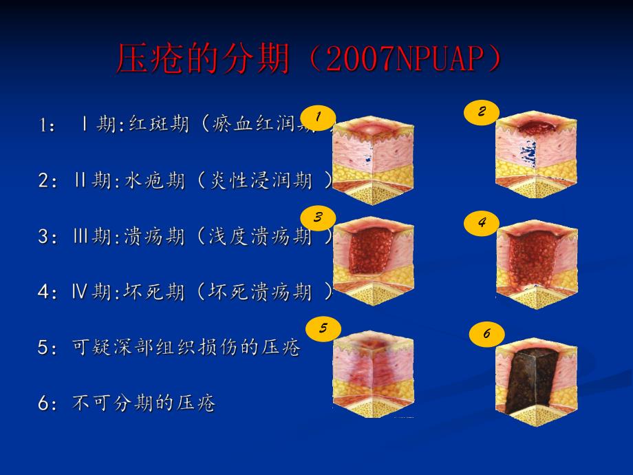 围手术期压疮.ppt_第3页