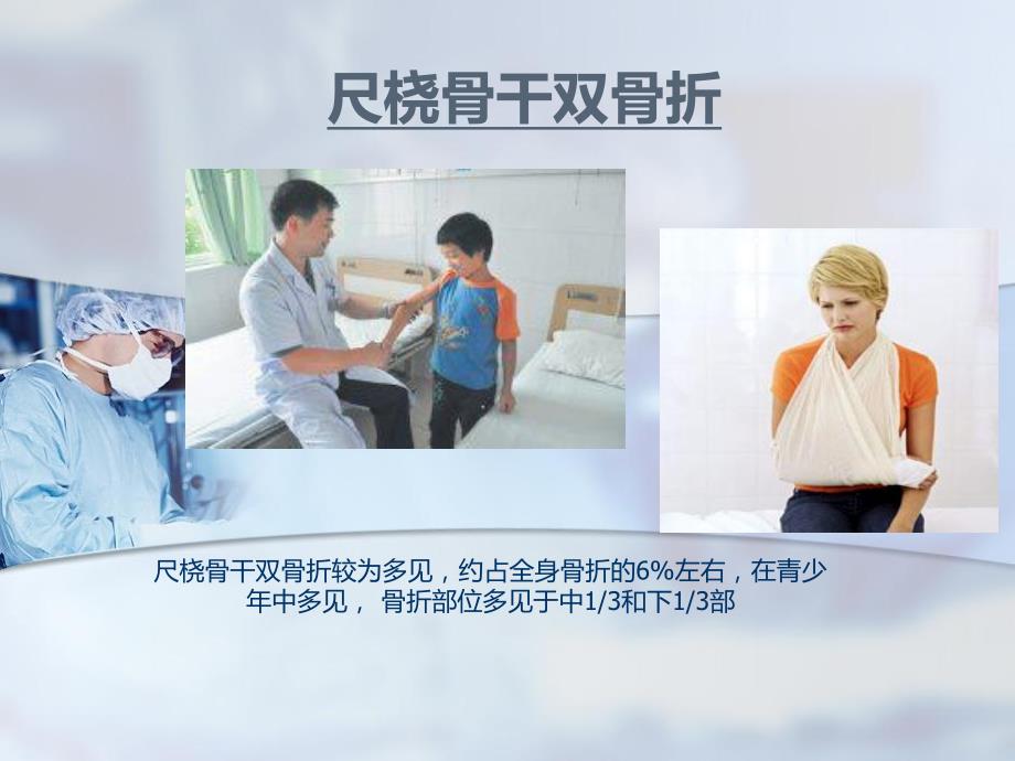 尺桡骨干双骨折.ppt_第1页