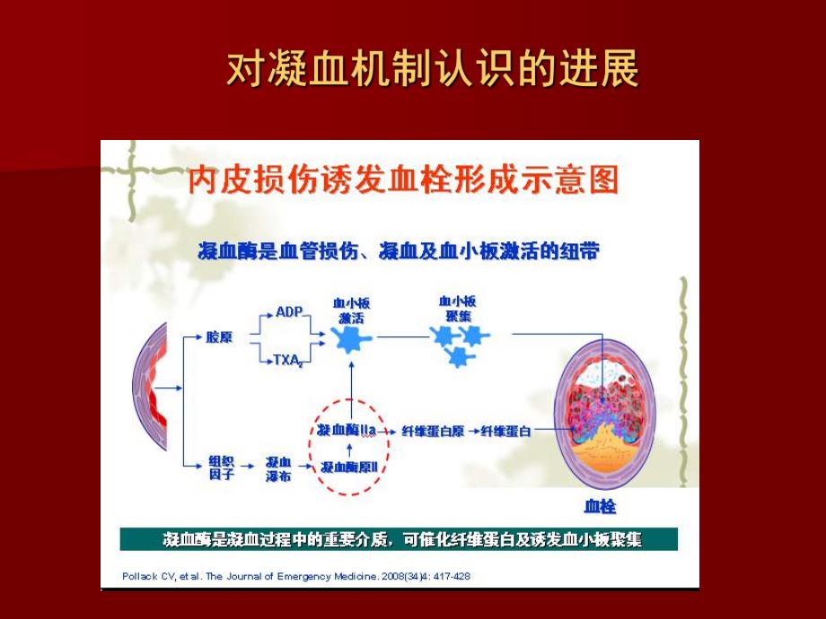 围术期抗栓治疗处理对策+科室讲课.ppt_第3页