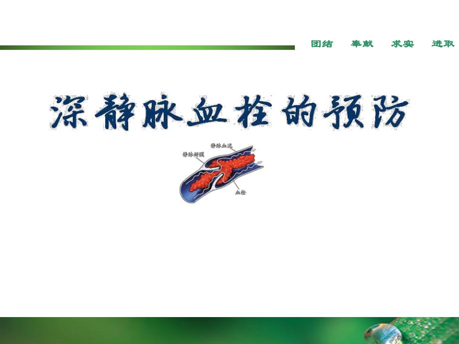 深静脉血栓的预防.ppt_第1页