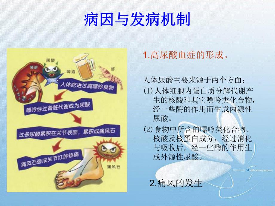 痛风性关节炎及护理.ppt_第3页