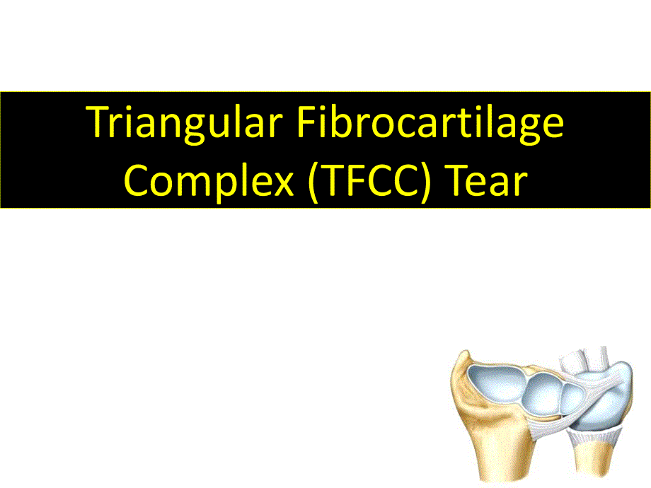 关节镜下治疗腕三角软骨损伤英文版.ppt_第1页