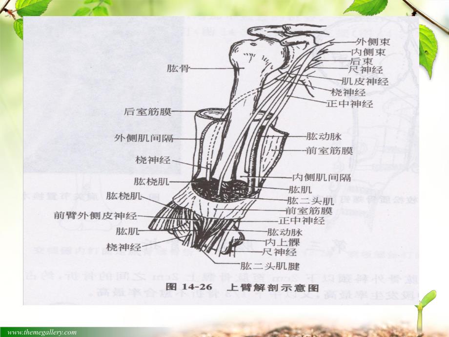 总院肱骨骨折护理查房ppt精简版.ppt_第3页