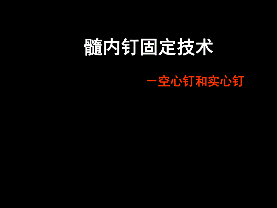 AO髓内钉固定技术.ppt_第1页