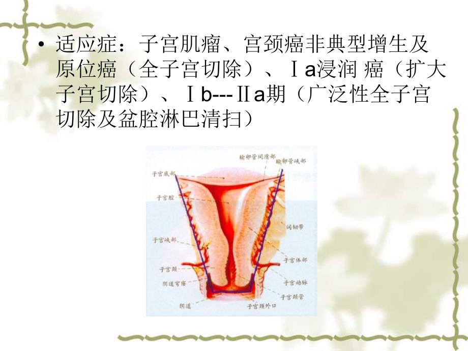 手术配合教学课件腹宫.ppt_第3页