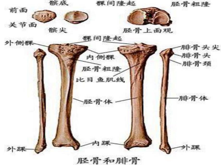 踝关节骨折护理查房.ppt_第3页