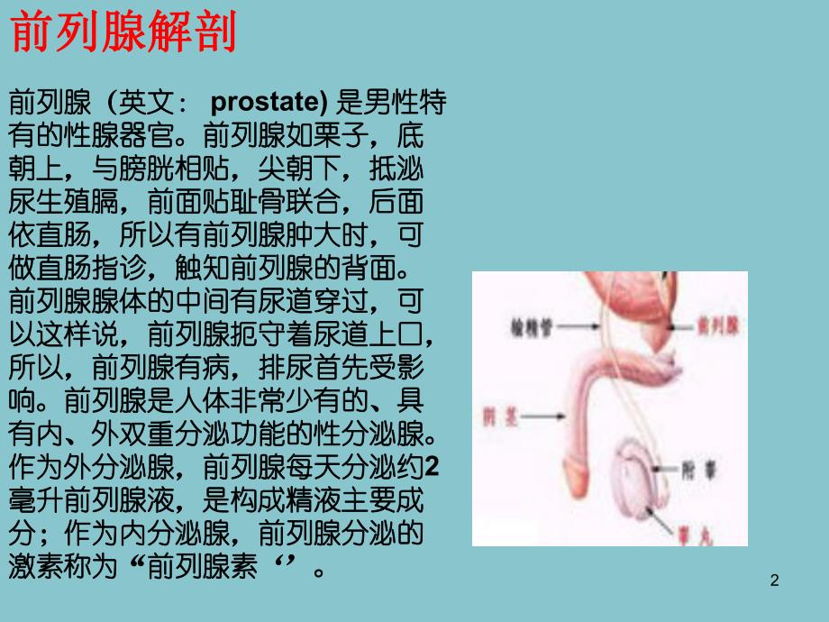 前列腺点切术术后护理.ppt_第2页