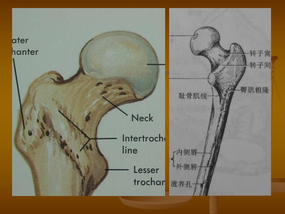 [整理版]股骨头缺血坏死的影像学诊断.ppt_第3页